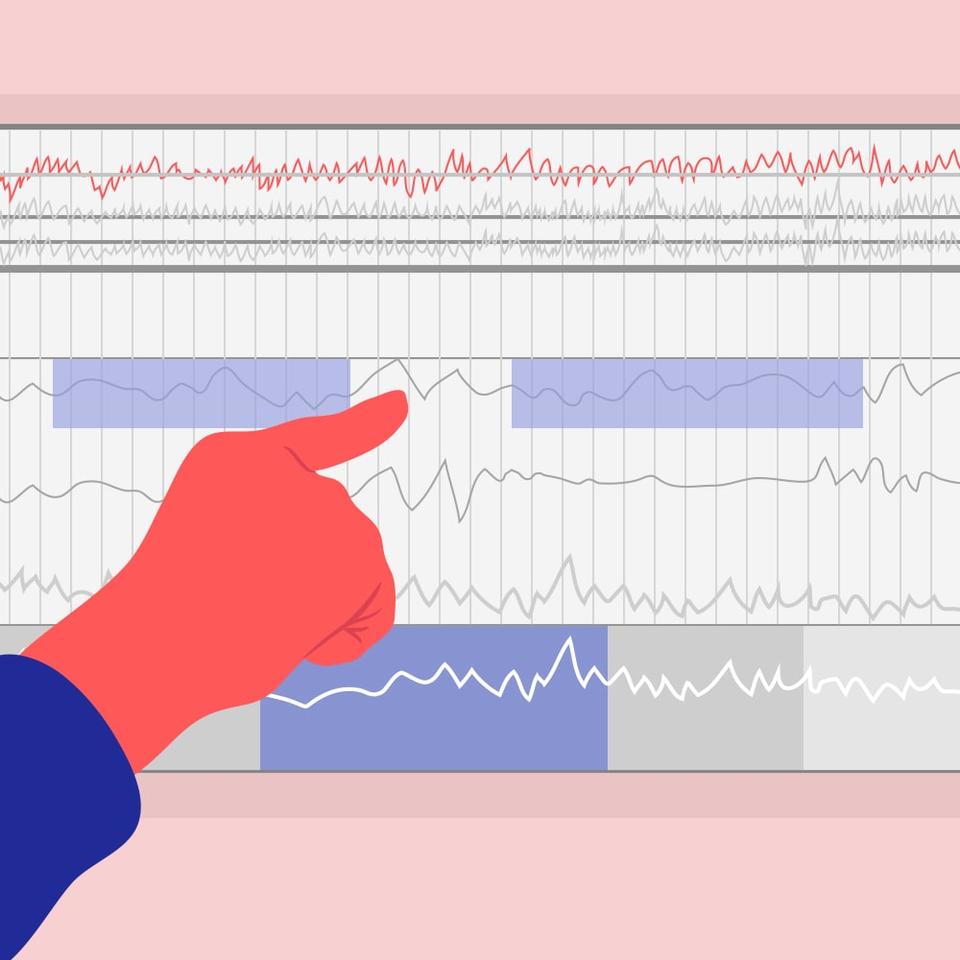 Once your sleep study is complete, it usually takes up to two weeks to compile all of your data. Your doctor will then review your results with you and communicate any findings.
