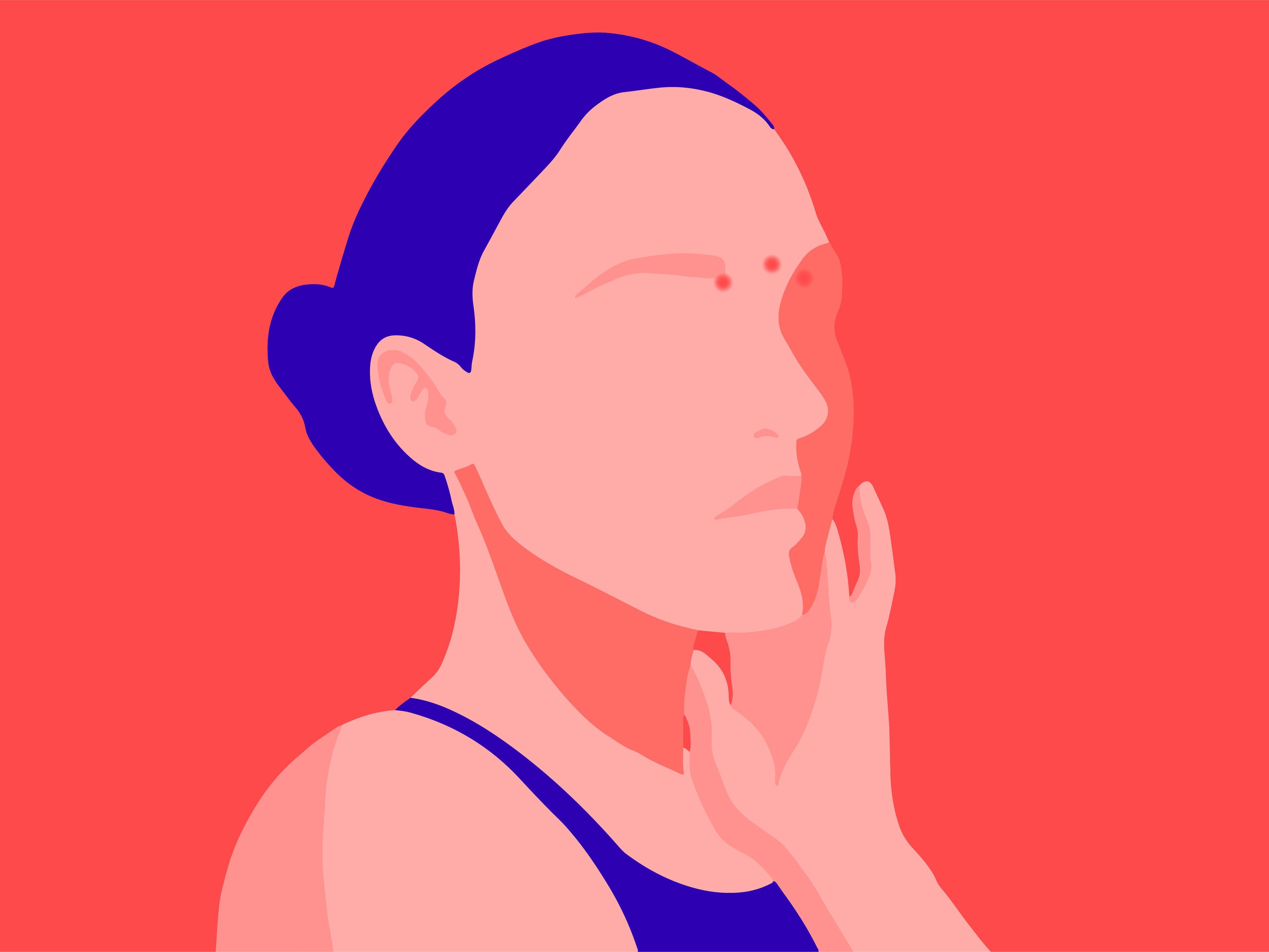 A girl’s face with red dots on the acupressure points for migraine and sinus pain.